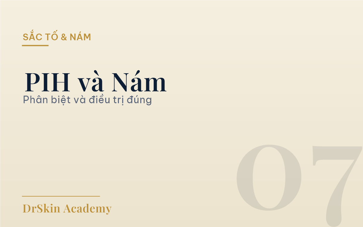PIH nám sau viêm khác nám thường
